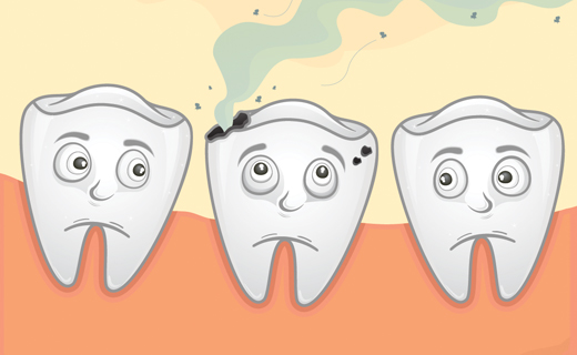 Cavity Prevention