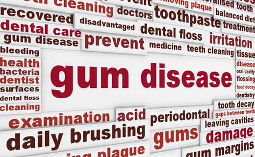dca-blog_gum-disease